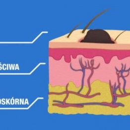 Co to jest czerniak?